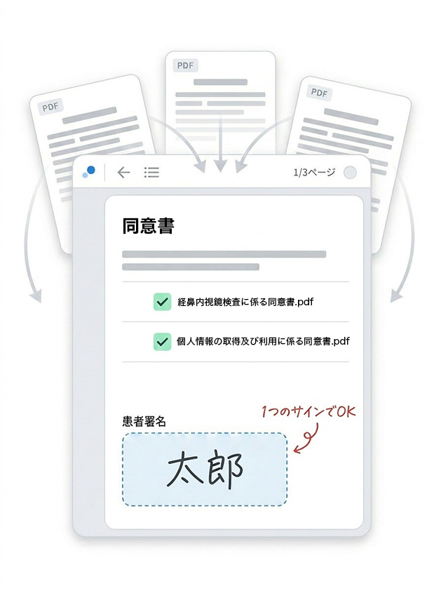 一括同意